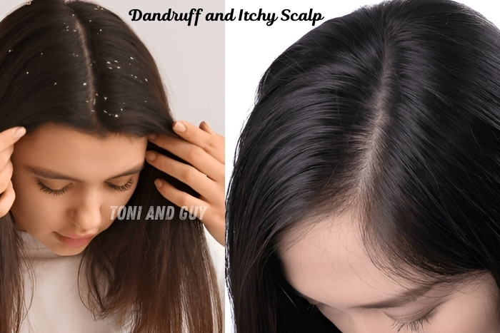 Toni & Guy Coimbatore it's provide Professional solutions to remove flakes, dryness, scalp dandruff, itchy and irritation 