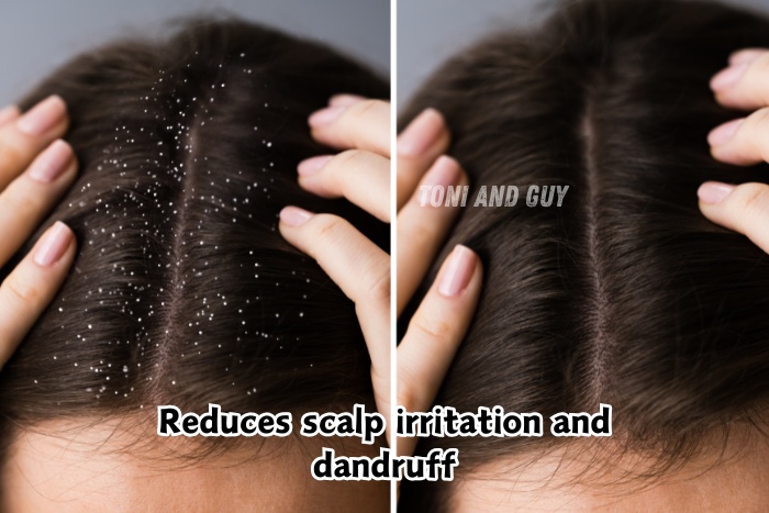 Professional dandruff reduction service showing cleaner, healthier scalp results at TONI & GUY Coimbatore